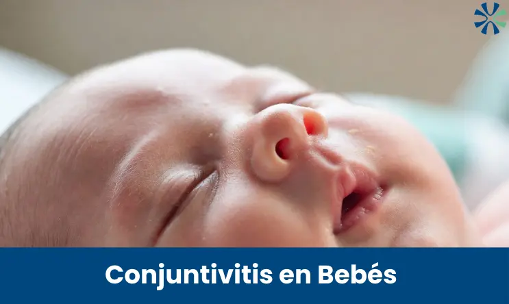 conjuntivitis en bebes