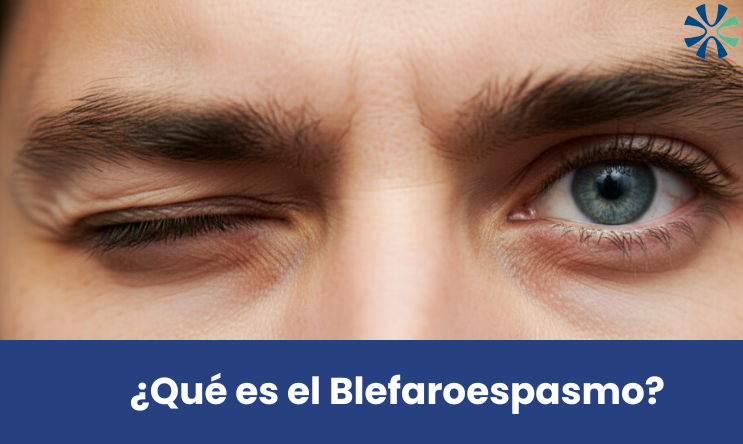 Que es el blefaroespasmo